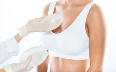 10 dúvidas frequentes sobre prótese mamária